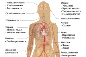 Гипотиреоз альтернативное лечение щитовидной железы