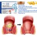 Натуральное средство от геморроя South Moon Natural Herbs Strength Hemorrhoids 7 травяных капсул