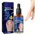 Removal Paronychia Oil Масло для удаления паронихии 10 грамм