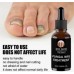 EELHOE Nail Repair – Fungal Nail Treatment, масло для лечения грибка ногтей 50 мл. 