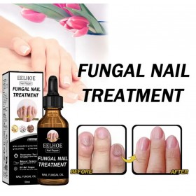 EELHOE Nail Repair – Fungal Nail Treatment, масло для лечения грибка ногтей 50 мл. 