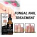 EELHOE Nail Repair – Fungal Nail Treatment, масло для лечения грибка ногтей 50 мл. 
