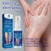 Спрей от варикозного расширения вен OUHOE Varicose Vein Spray 30 мл.
