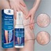 Спрей от варикозного расширения вен OUHOE Varicose Vein Spray 30 мл.