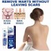 Мазь для удаления бородавок EELHOE Wart Remover Ointment 20гр.
