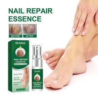 Эссенция для восстановления ногтей NAIL REPAIR  Essence OUHOE 