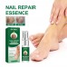 Эссенция для восстановления ногтей NAIL REPAIR  Essence OUHOE 