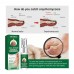 Эссенция для восстановления ногтей NAIL REPAIR  Essence OUHOE 